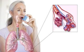 Можно ли лечить бронхиальную астму травами?