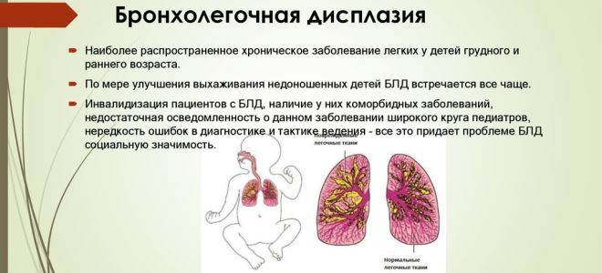 Последствия хронической обструктивной болезни легких