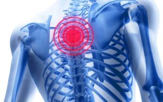 Как лечить остеохондроз грудной клетки и его симптомы?