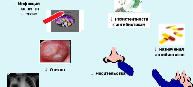 Пневмококковая инфекция: симптомы, лечение, прививки