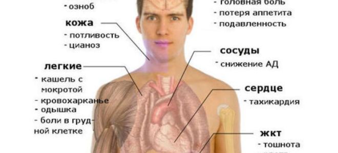 Причины, симптомы и лечение очаговой пневмонии у детей