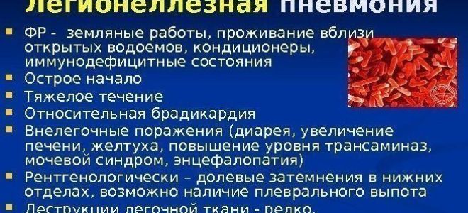 Причины появления и основные методы лечения легионеллезной пневмонии
