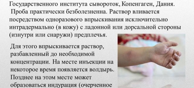 Является ли тубпроба обязательной для всех?