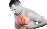 Спазматические боли в грудной клетке