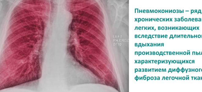 Пневмокониоз: причины и лечение