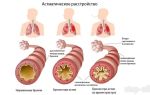 Вредно ли курение при заболевании бронхиальной астмой?