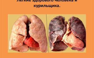 Опасность табакокурения при воспалении легких