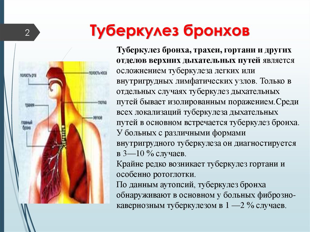 Туберкулез глотки презентация